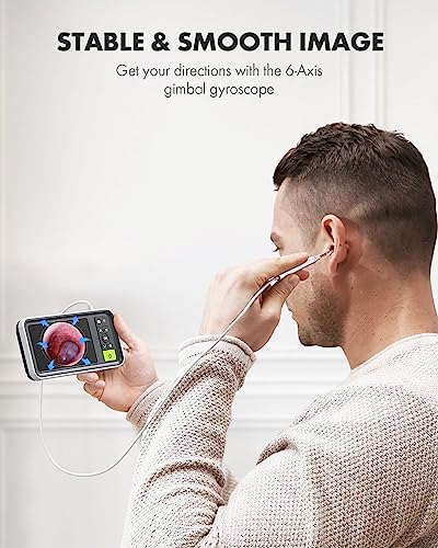 Anykit Digital Otoscope with Gyroscope, 4.5" Screen, Ear Wax Removal Tool C80173