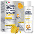 Pharmlitalia Psoriasis Shampoo for Dry & Itchy Scalp with Salicylic Acid 3% - Psoriasis Scalp Treatment for Eczema Relief, Seborrheic Dermatitis, Ringworm & Folliculitis 6.76 Fl Oz