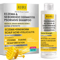 RHRI Psoriasis Shampoo Itchy Scalp Treatment for Seborrheic Dermatitis