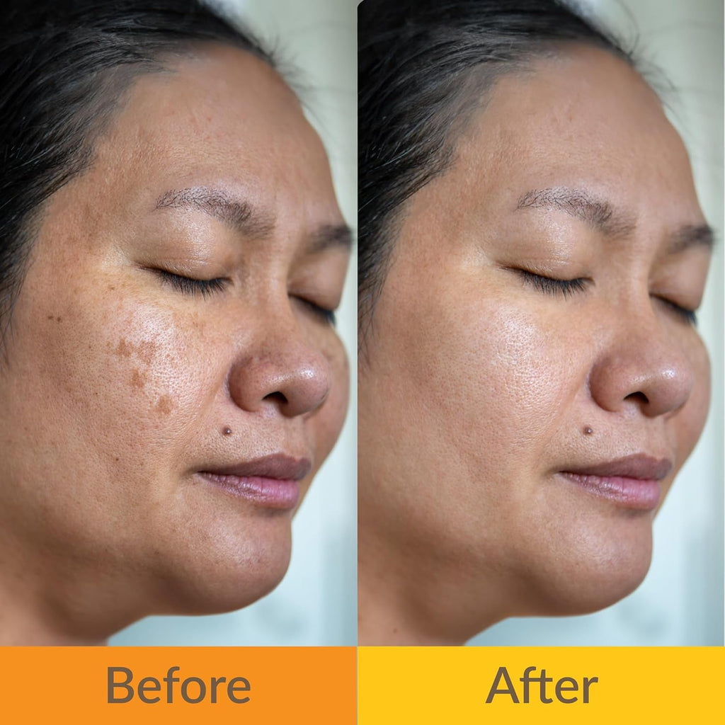 Yoove Turmeric and Kojic Acid Soap with Exfoliating Scrubber, 3-Pack P284